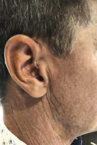 Melody on Ear